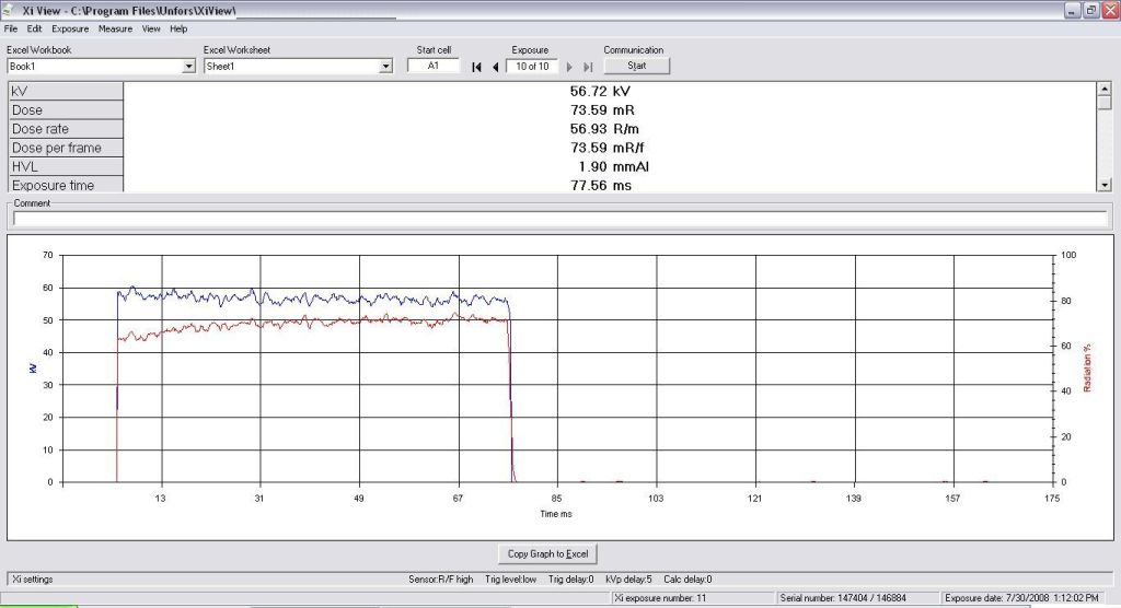 XRay Calibration to RTech Dental